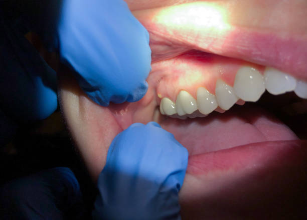 Best Emergency Gum Pain Relief  in Pine Bush, NY