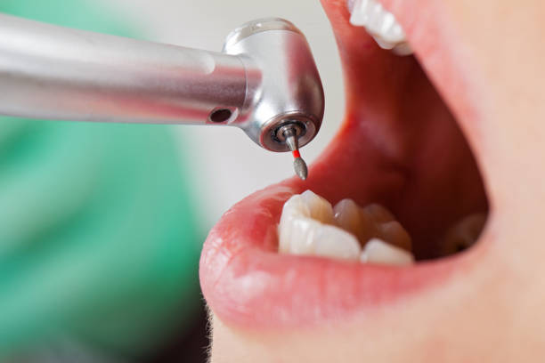 Best Urgent Tooth Repair  in Pine Bush, NY